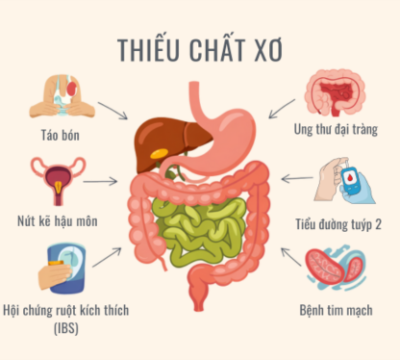 THIẾU CHẤT XƠ: NGUY CƠ TIỀM ẨN ẢNH HƯỞNG ĐẾN SỨC KHỎE BẠN CẦN BIẾT